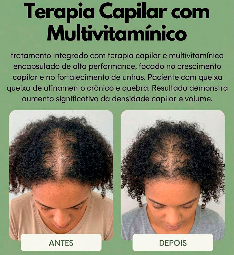 Foto Antes e Depois - Patrícia Santos