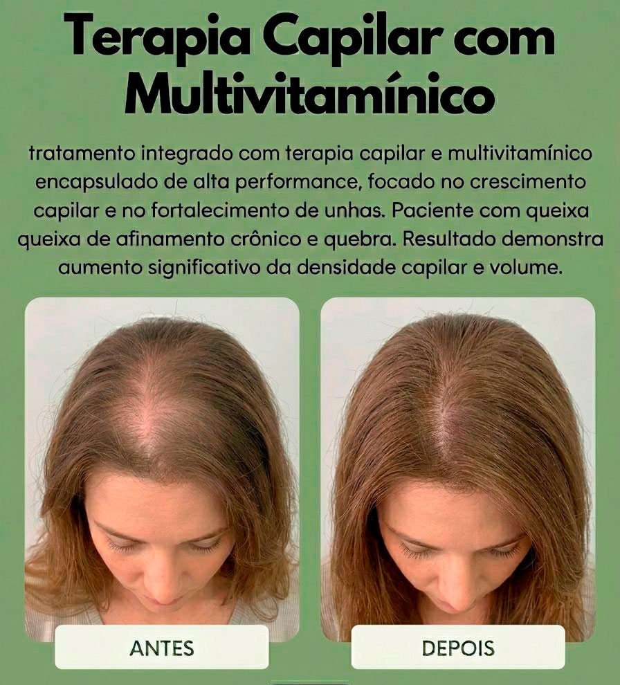 Foto Antes e Depois - Ana Beatriz